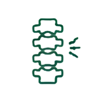 Spondylosis