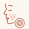 Acne & Breakouts