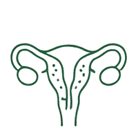 Adenomyosis & Endometriosis